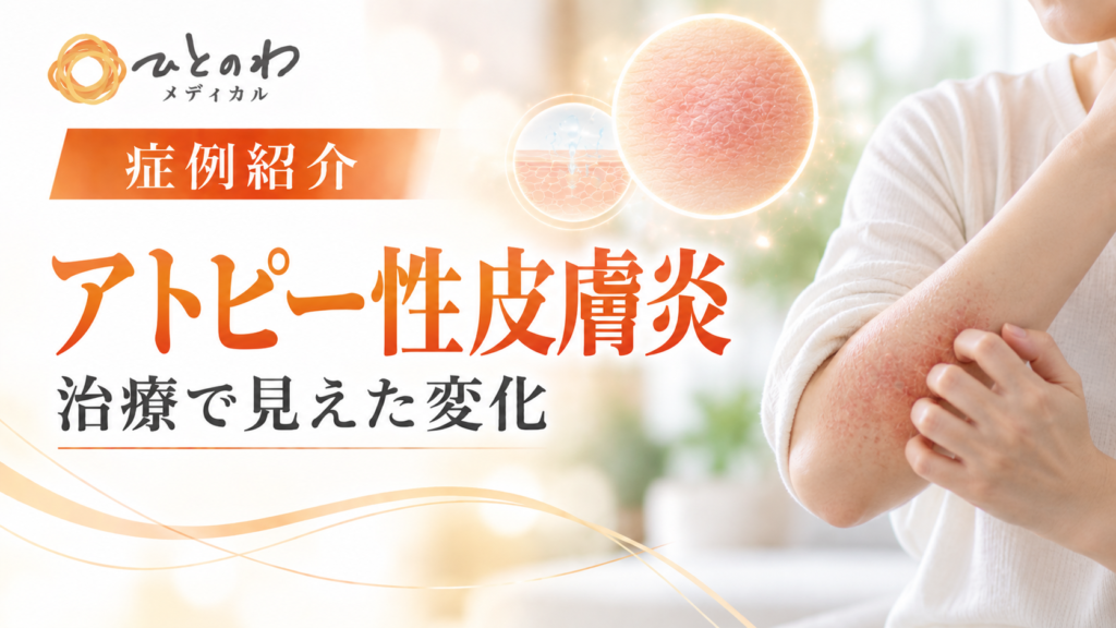 40代男性｜難治性アトピー性皮膚炎のイメージ写真
