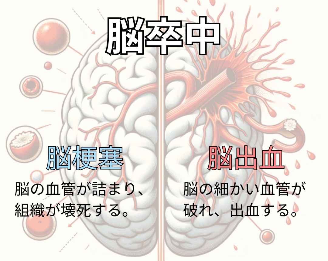 脳梗塞の後遺症の症状とはのイメージ